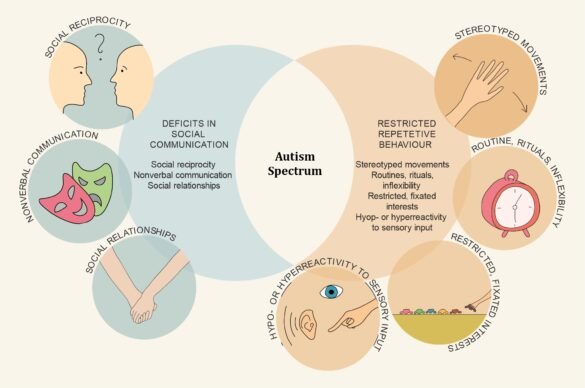 Option Map Asd Autism Diary: Residential Spaces: Layout and Designs - South Asian Herald